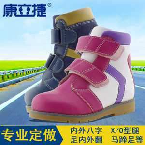大人内八字脚如何矫正(大人内八字脚如何矫正图片)