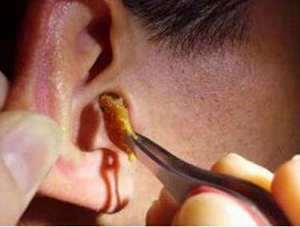 做梦梦见揪人耳朵流血(做梦梦见揪人耳朵)