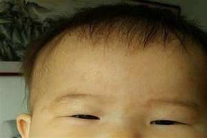 脸上有红血丝怎么弄才能消除(脸上有)