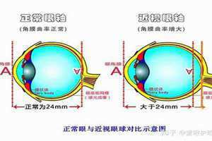 中眼泡是怎么回事 中眼集团