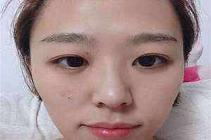 人中歪是什么原因引起的 人中歪了怎么调整