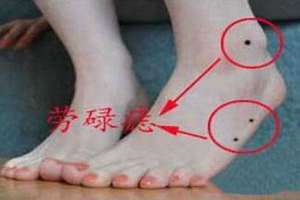 脚后跟长痣的女人好不好(脚后跟长痣)