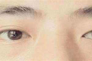 龙凤眼的女人命运左双右单 龙凤眼的女人命运怎么样