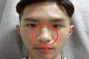 鼻孔大的男人命好吗(鼻孔大的男人)