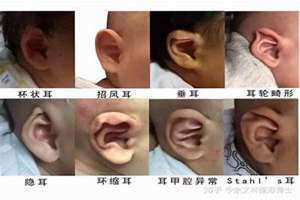 耳骨外翻的女人命运 耳骨外翻的女人面相