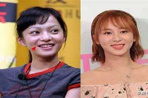 矫情纹的女生面相 矫情纹是什么样子