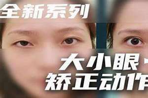 大小眼整形手术大概多少钱(大小眼)