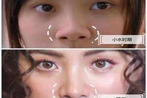 小鼻子的男人说明什么(小鼻子)