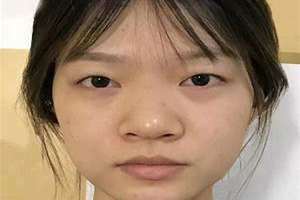 蒜头鼻子的男人命运(蒜头鼻子)