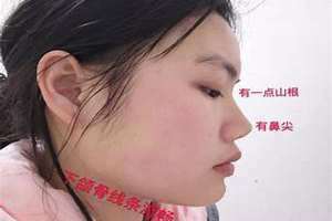 挺鼻梁和塌鼻梁对比男生 挺鼻梁和塌鼻梁对比面相