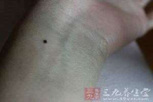 手腕有痣的男人(手腕有痣)