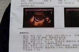 免费测生男宝女宝计算器 怀男孩晨尿颜色已生宝妈验证