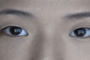 眼睛一单一双做手术多少钱 眼睛一单一双是什么原因