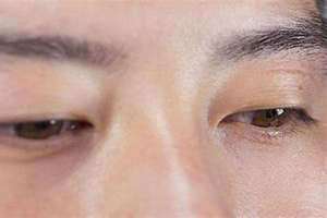 左眼皮跳是什么意思有什么征兆 左眼皮跳是什么好事还是坏事
