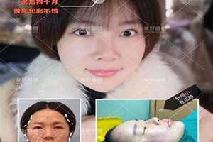 苦瓜脸女人面相克夫吗 苦瓜脸女人面相命运