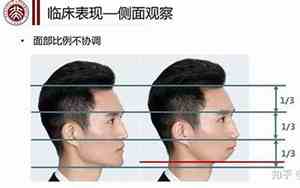面相男生没下巴的人怎么样