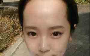 儿童发际线高好吗