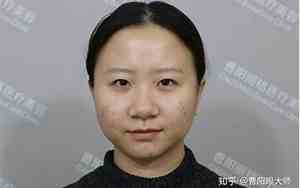 大蒜鼻的女人命好不好