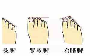 脚趾长短看性格命运 男人