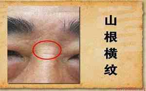 山根偏左有痣叫什么痣