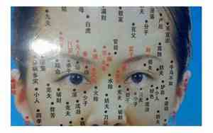 上眼睑长瘊子