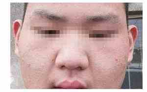 脸肉肉的男生有多可爱