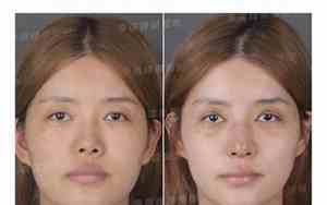 女人面中部凹陷面相分析