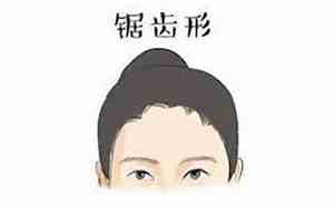 女性发际线和男性发际线区别