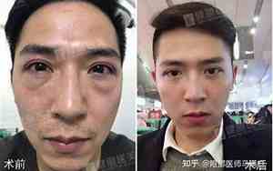 眼袋很大面相男生好吗