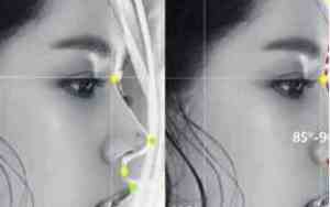 侧脸突出的人面相怎么样