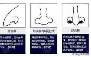 猪头鼻怎么矫正
