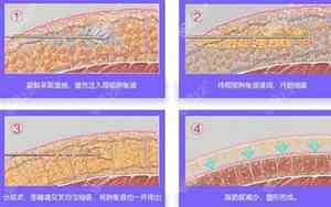 吸脂肪20斤大概需要多少钱