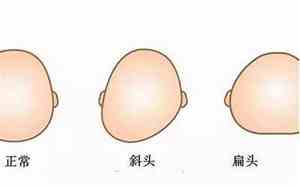 头型扁头是什么面相女图片