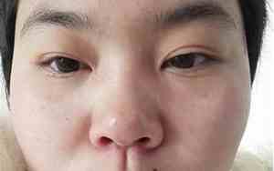 鼻头小鼻翼大面相女生