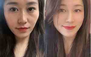 侧脸饱满突出面相图片