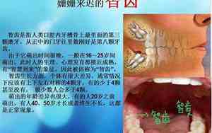13岁长智齿正常吗?