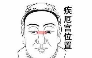 老寿星的特征