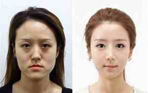 女人地包天面相好不好,真的是克夫相么