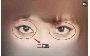 眼白有斑 面相