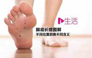 脚底长痣男人命运