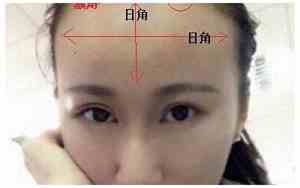 额头突然有个凹陷是生病了吗