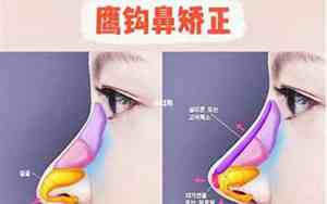 女生鹰钩鼻面相 女人鹰钩鼻好吗