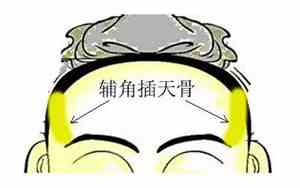 三棱骨疼什么原因