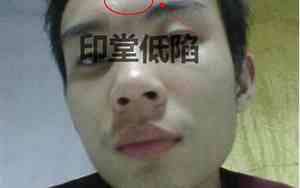 声音阴柔的男人命运