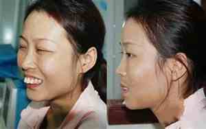 大龅牙女人图片