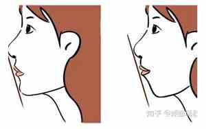 侧面看下巴薄面相女