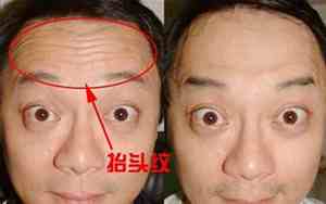 为啥要远离抬头纹的男人