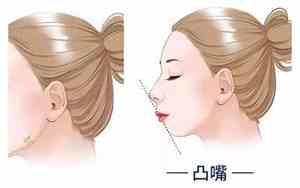 嘴向外凸的女孩面相怎么样