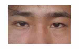 冷漠女人的面相特征是什么