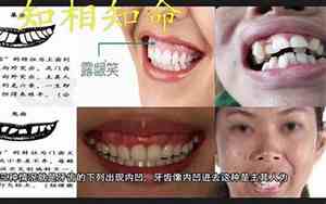 侧面露牙的面相女性